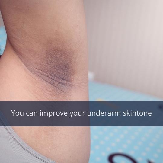 Dark Arm Pit Gotta Go! - EmGe Naturals